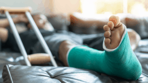 Broken foot personal injury in Brandon, Florida